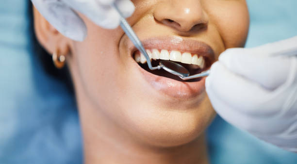 Best Urgent Care for Lost Fillings or Crowns in Breaux Bridge, LA